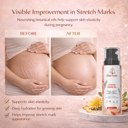 Carryharb™ Stretch Marks Oil